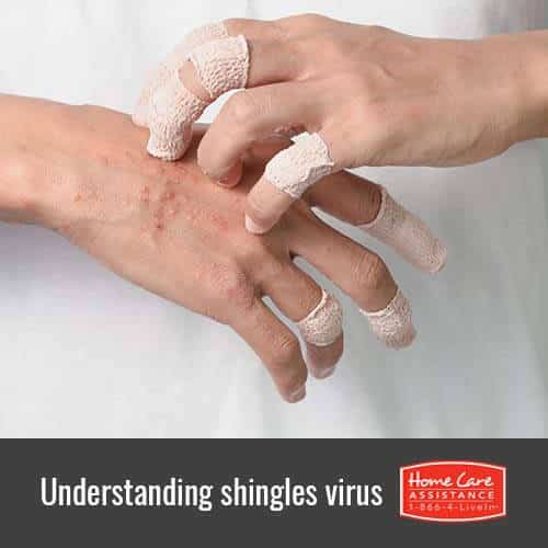 Senior Health: Understanding Shingles