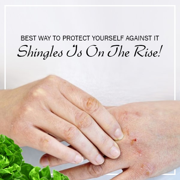 Shingles is on the Rise! Best Way to Protect Yourself